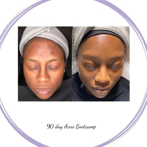 CB82574E-169B-4670-AC1C-E88A51C1ABC2