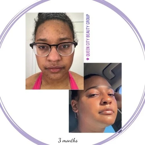 A734C430-2B33-4BC4-9849-8EFB8CF9B2D7