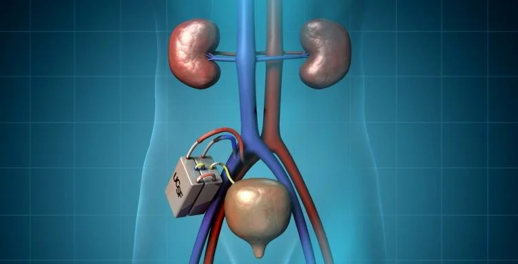 BIOARTIFICIAL KIDNEY Kidneys are bean-shaped, fist sized organs that sit on either side of the spine under the ribcage. The kidneys are made of amazingly intricate systems of microscopic filters and draining tubules called nephrons to filter around 150 litres of blood every day... By Aryan Wani