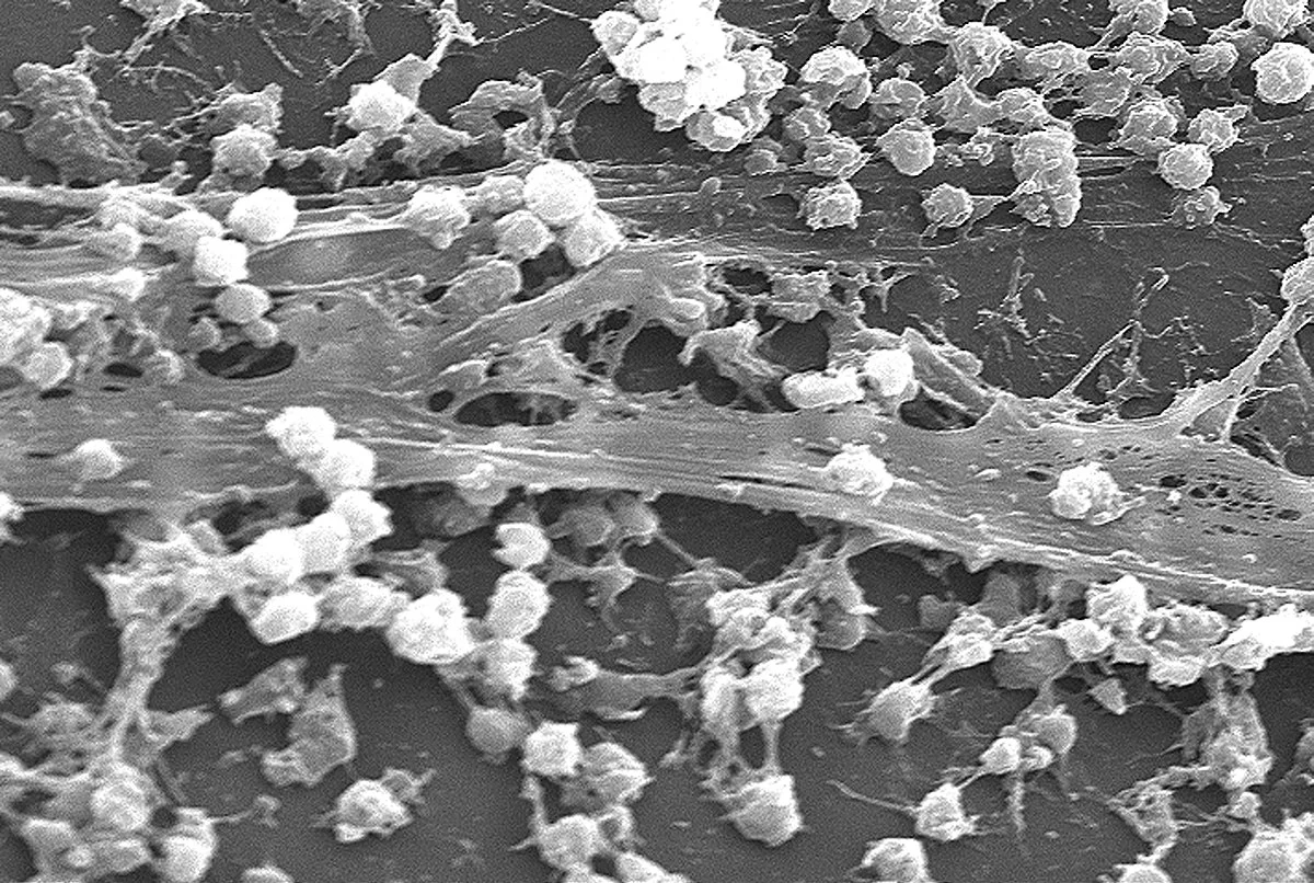 Biofilm with staph.jpg