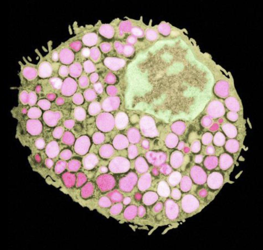 The Lesser Known Causes of Histamine &amp; Mast Cell Conditions