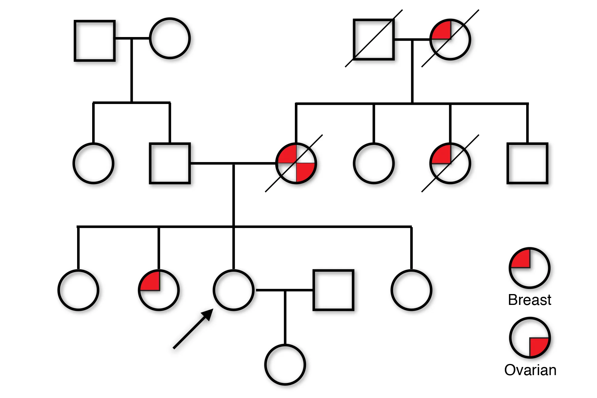 This family has a mutation in a gene called BRCA1. My client (arrow), who is 25, told me that every female relative she had on her mother's side was dead by age 50. Testing of her sister showed the mutation, which my client also had. Timely intervention saved her life.