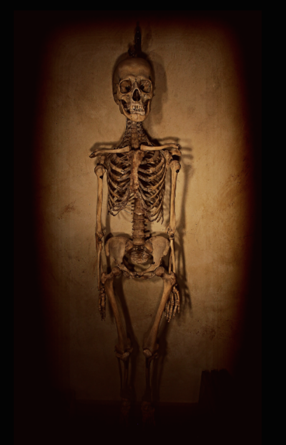Victorian Era Human Skeleton