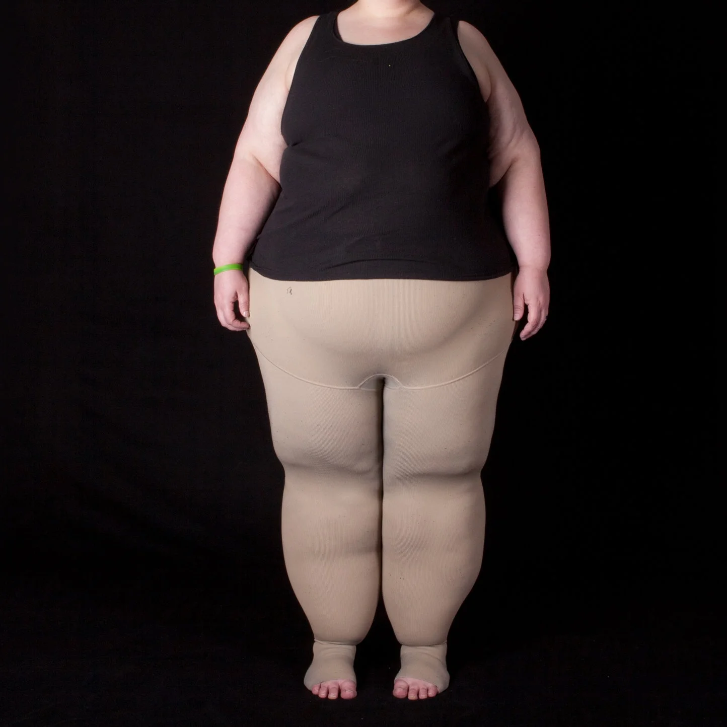 Photo by Fat Disorders Research Society compression Compression refers to articles of ‘medical’ clothing that literally compress the tissue underneath it. Think of it as giving your skin some extra help in propelling lymph fluid back to the trunk so your body can process it. By gently compressing tissue, fluid should not build up and cause problem