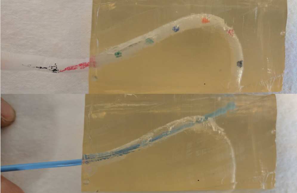 Soft catheter (top) goes around bends in soft phantom tissue 'ventricle', while standard catheter punctures