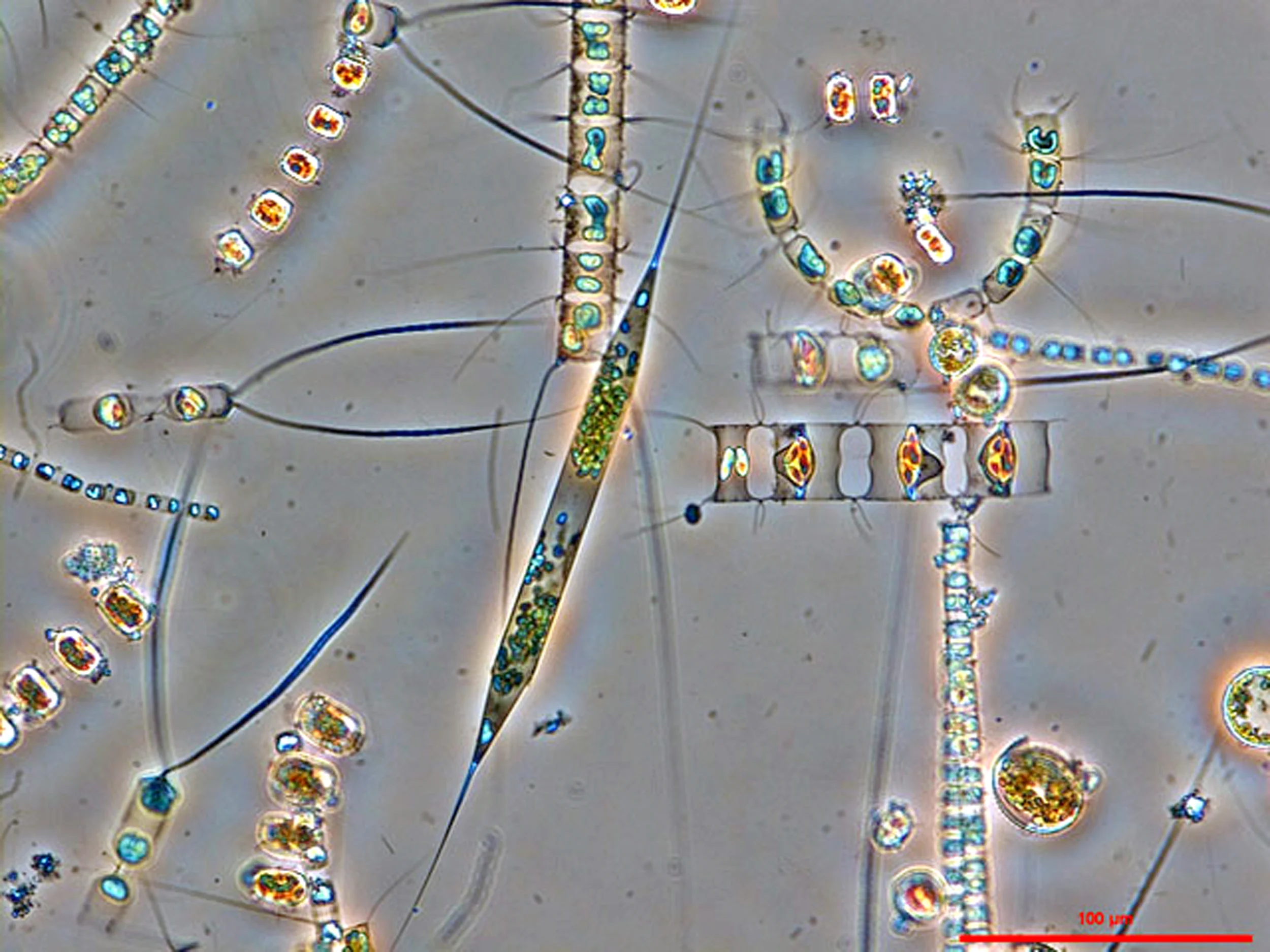 A microscope reveals marine diatom cells, which are an important group of phytoplankton in the oceans. Photo credit: Karl Bruun, Nostoca Algae Laboratory