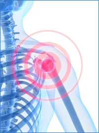 Shoulder-Arthritis-Inflamation.jpg