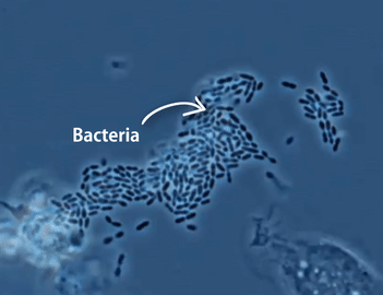 Transform-Bacteria-WhiteBloodCells.gif