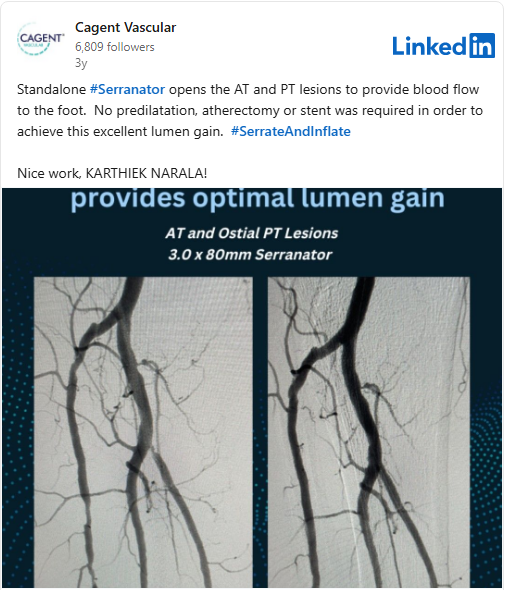 Using Serrantor