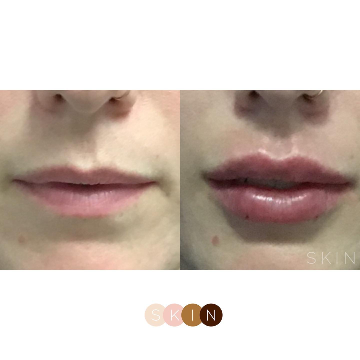Lips1.jpg