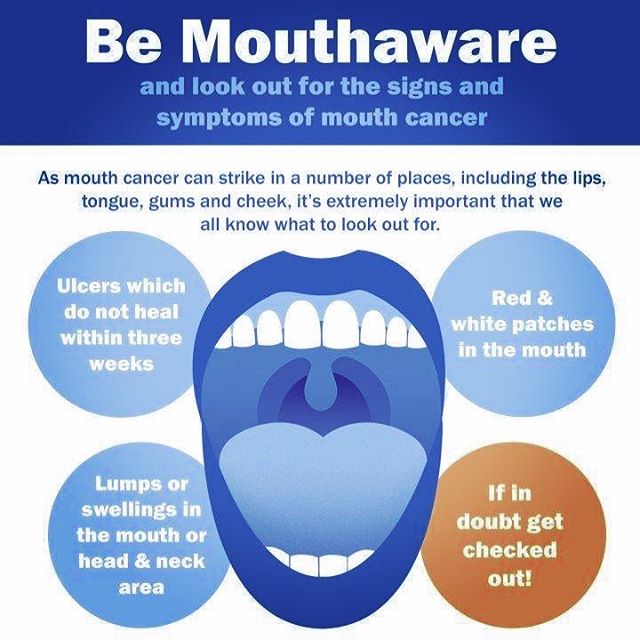 Did you know that November is Mouth Cancer Action Month?

Dental examinations are not just essential to check for any fillings or periodontal problems that may have arisen since your last visit but also to check for onset signs of mouth cancer.

Alth