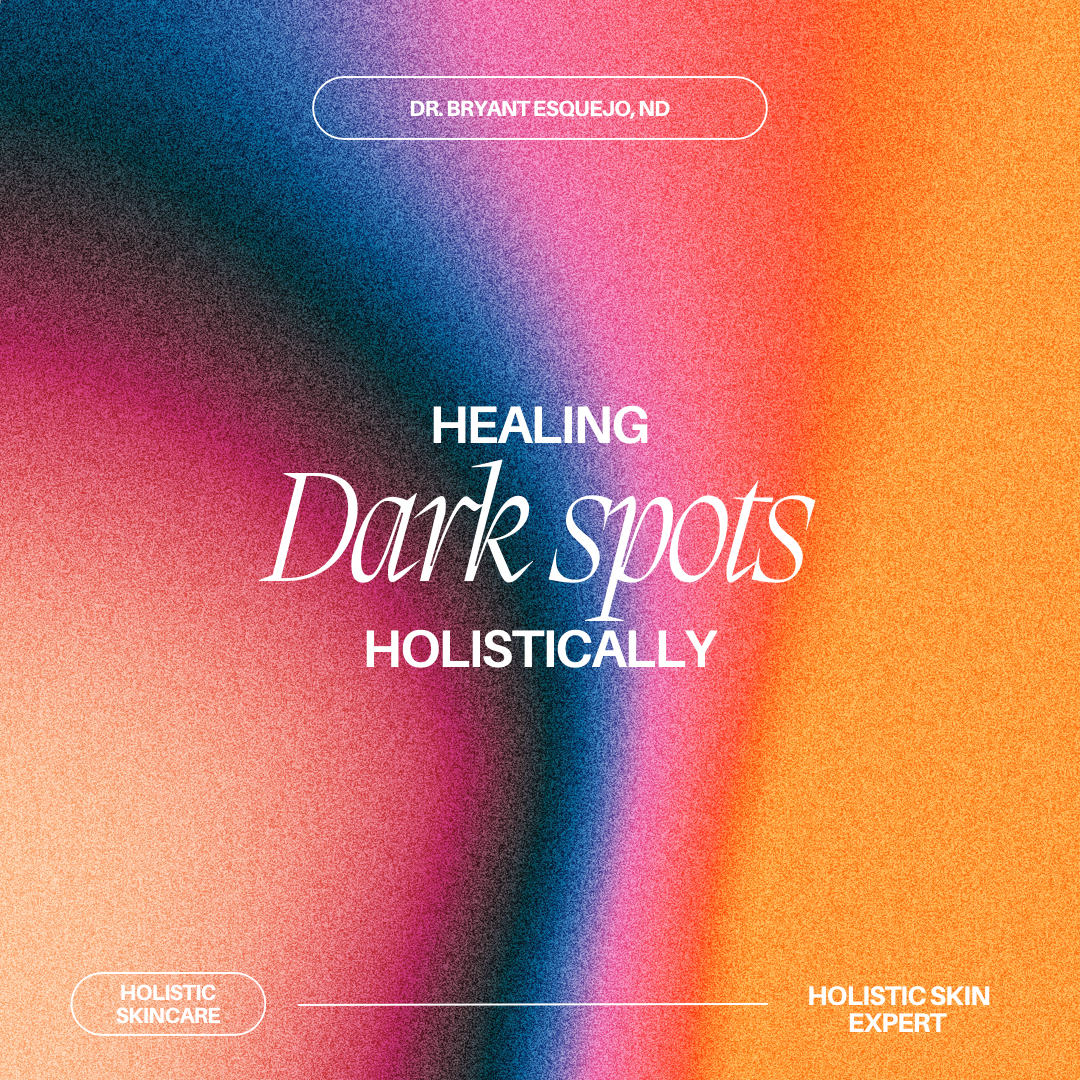 Healing Dark Spots Holistically