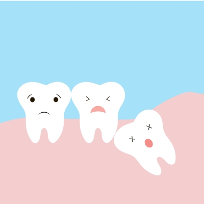 wisdom tooth