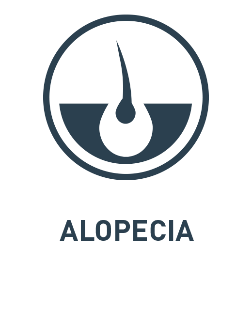 alopecia.png