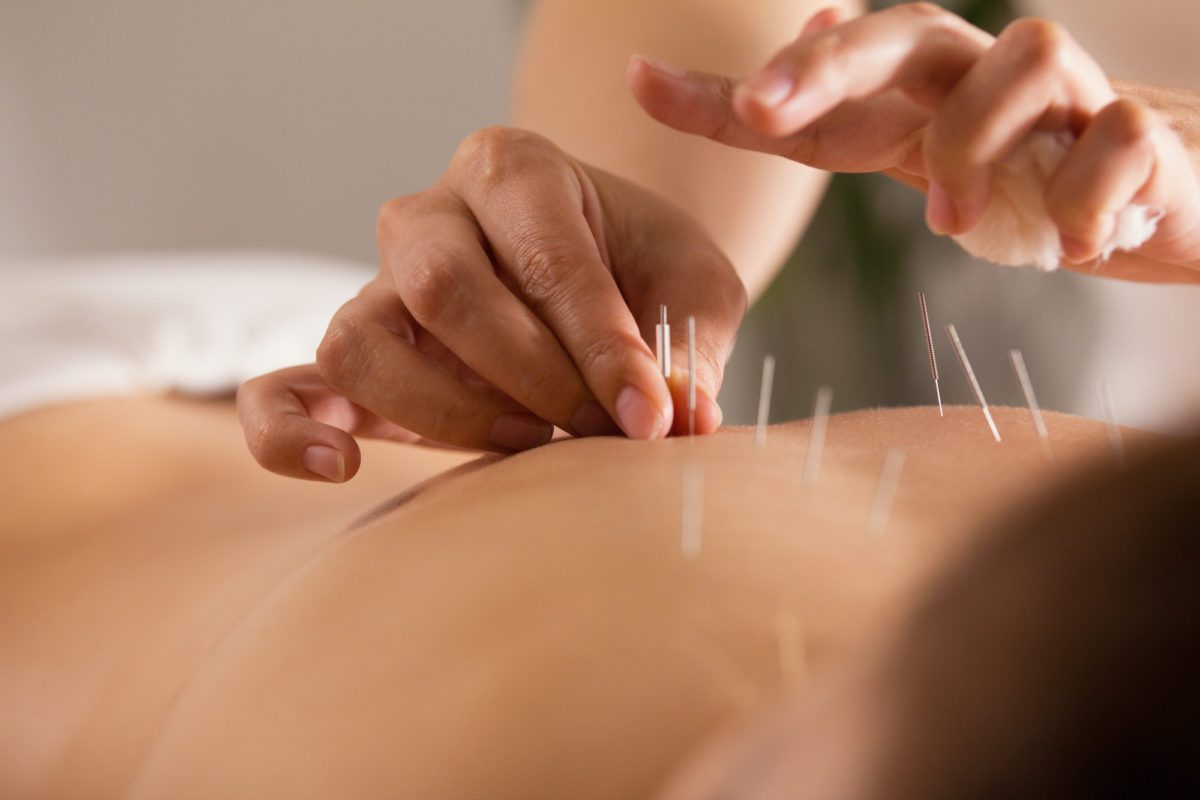 acupuncture-for-lower-back-pain-1200x800.jpeg