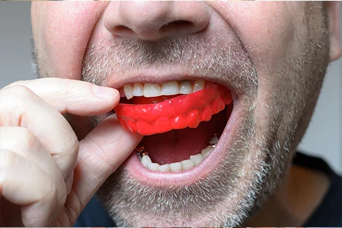 teeth grinding.jpg