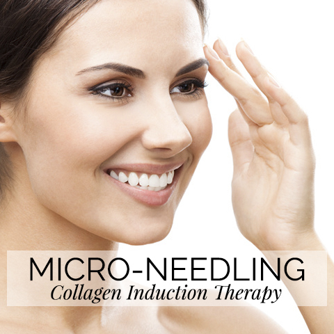 microneedling1.jpg
