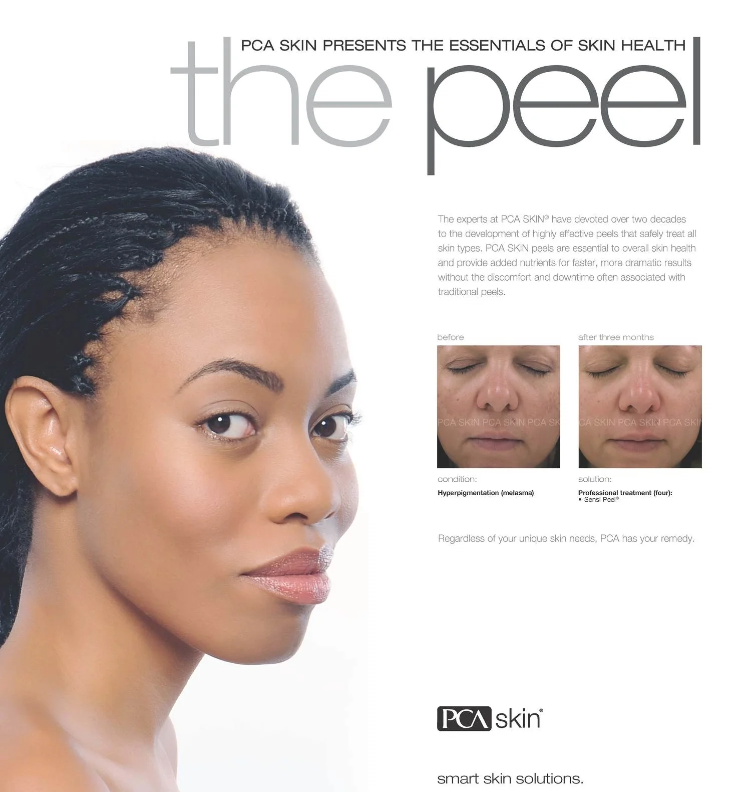 PCA PEEL.jpg