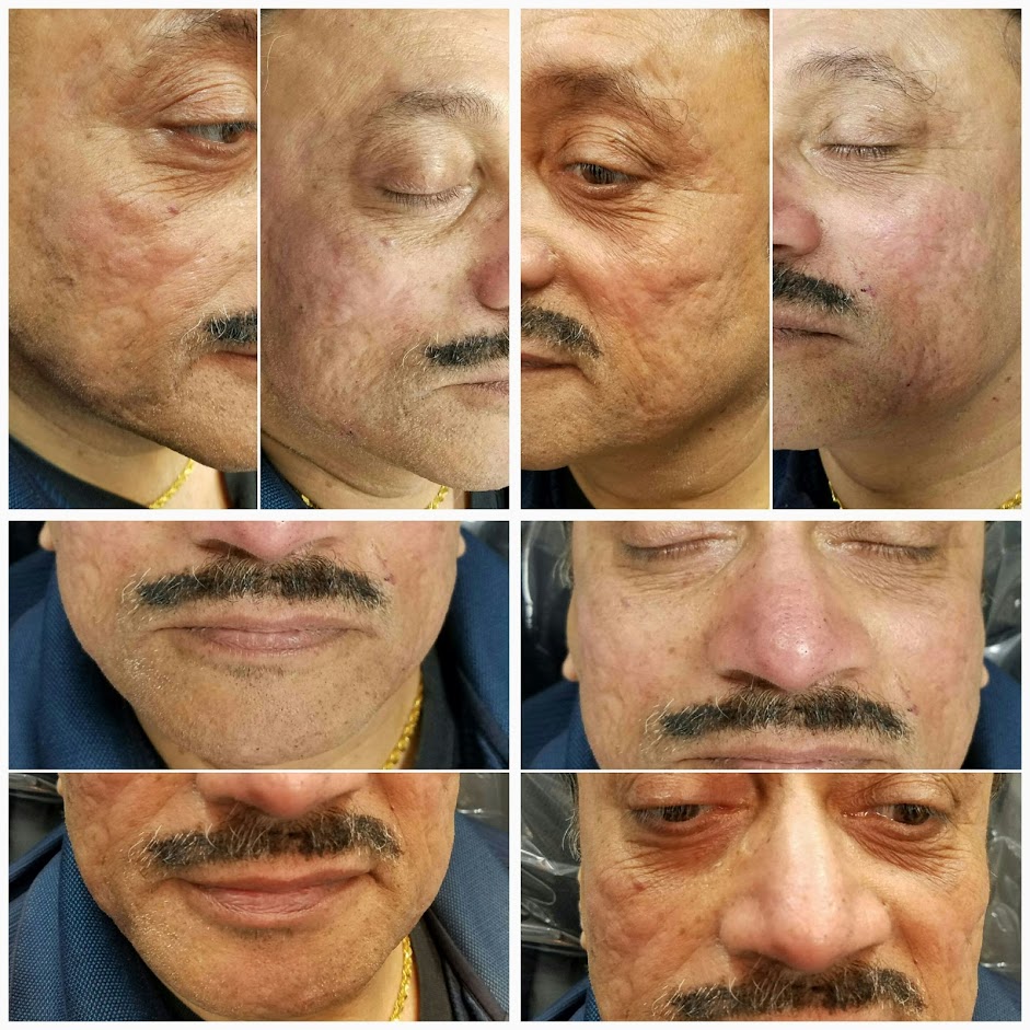 Facial rejuvenation.jpg