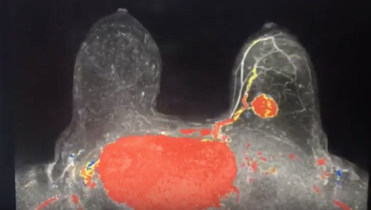 EP 1 Unit MRI .png