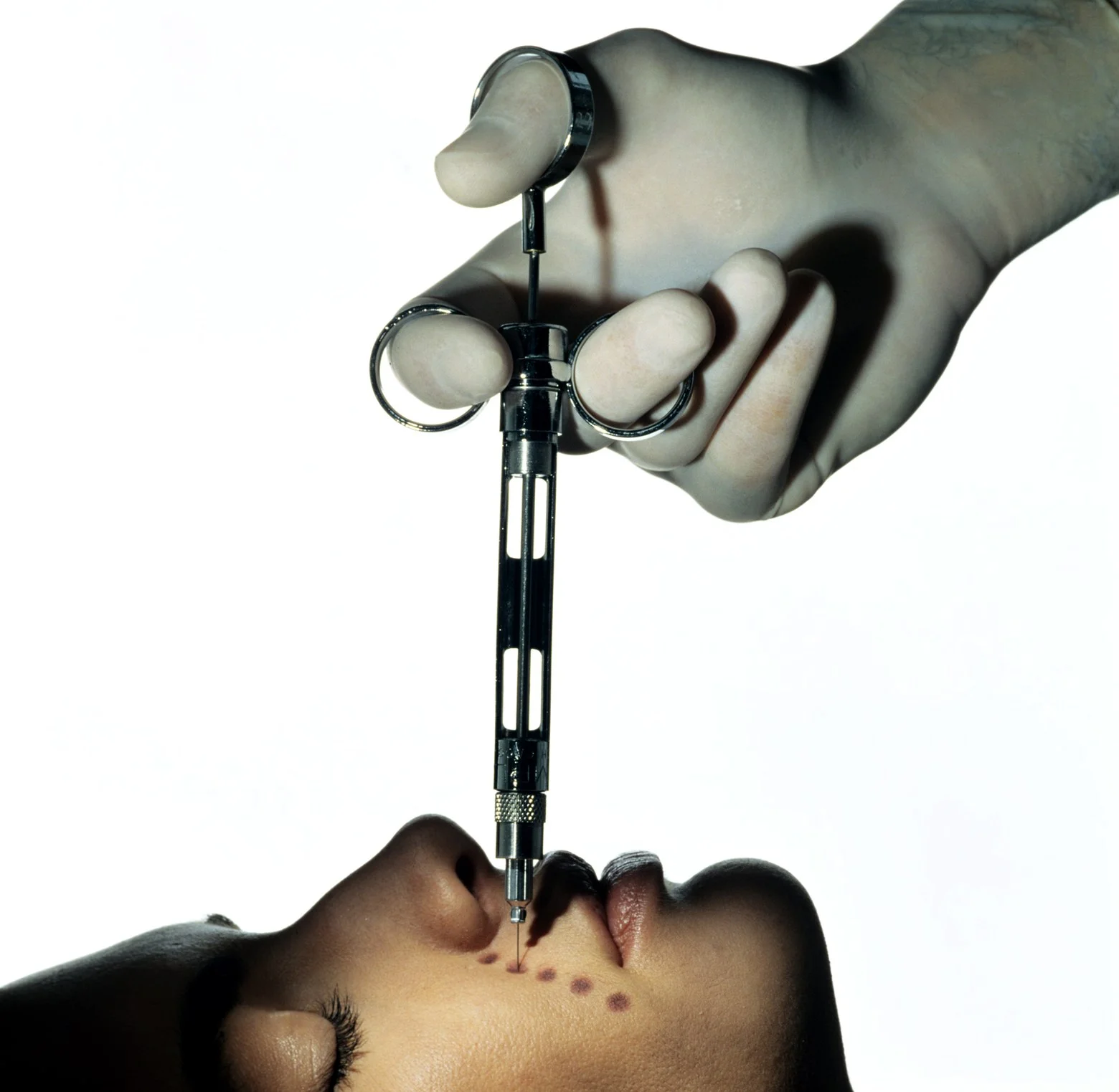 microneedling - vogue.jpg