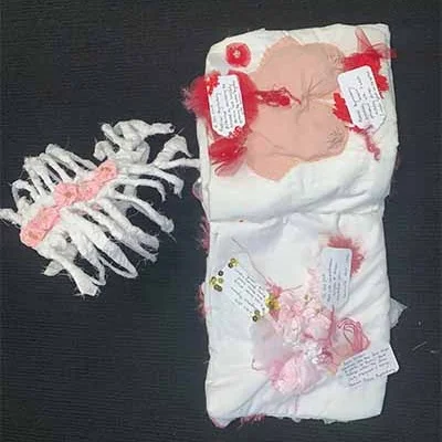Cancer survivor's soft sculpture records a harsh journey of recovery