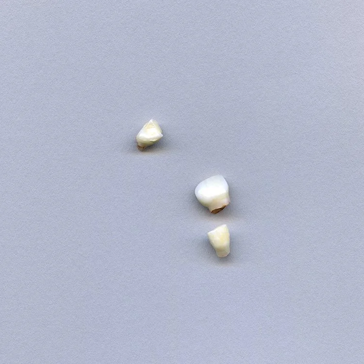 teeth002.jpg