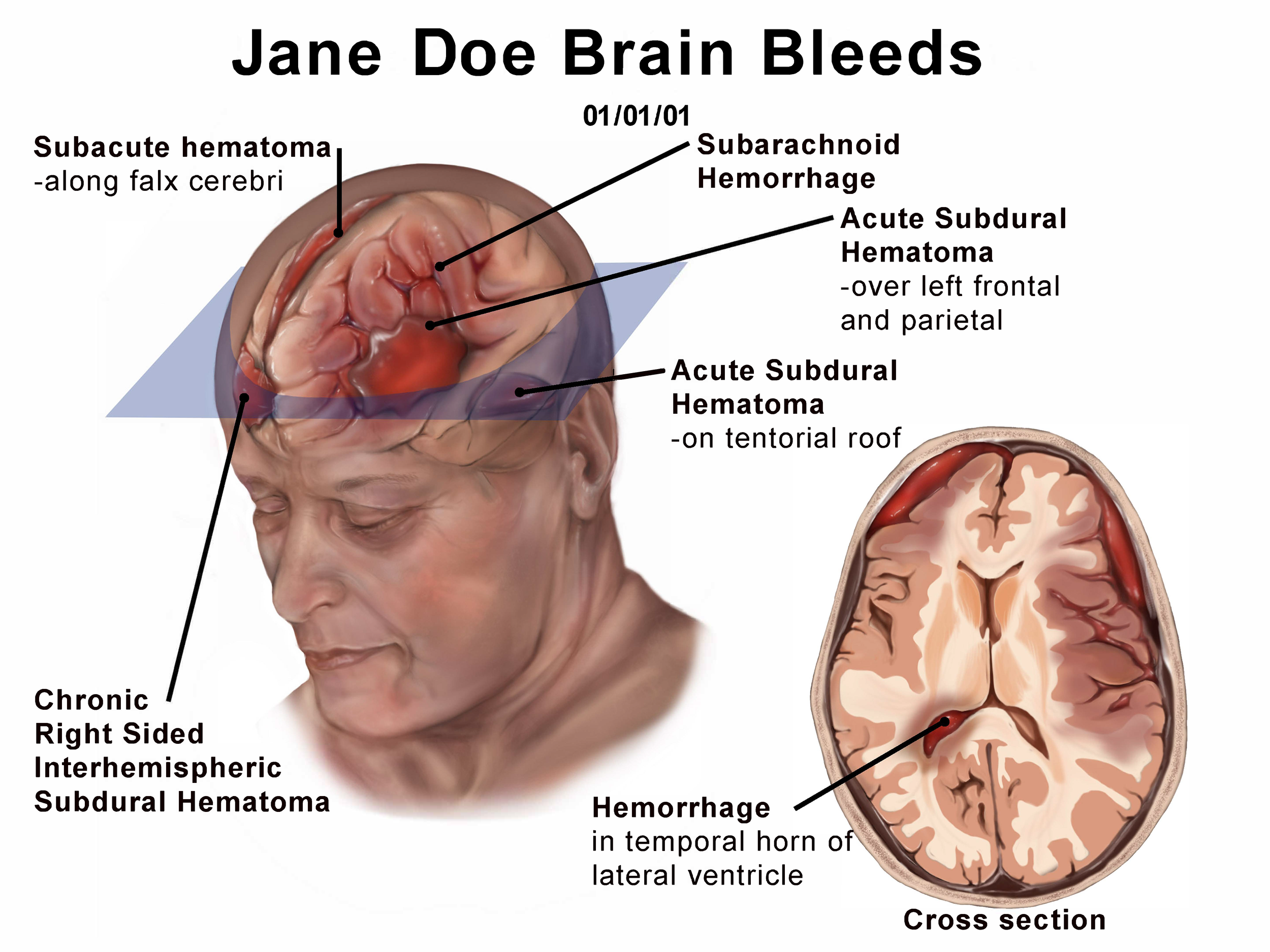Delayed Diagnosis