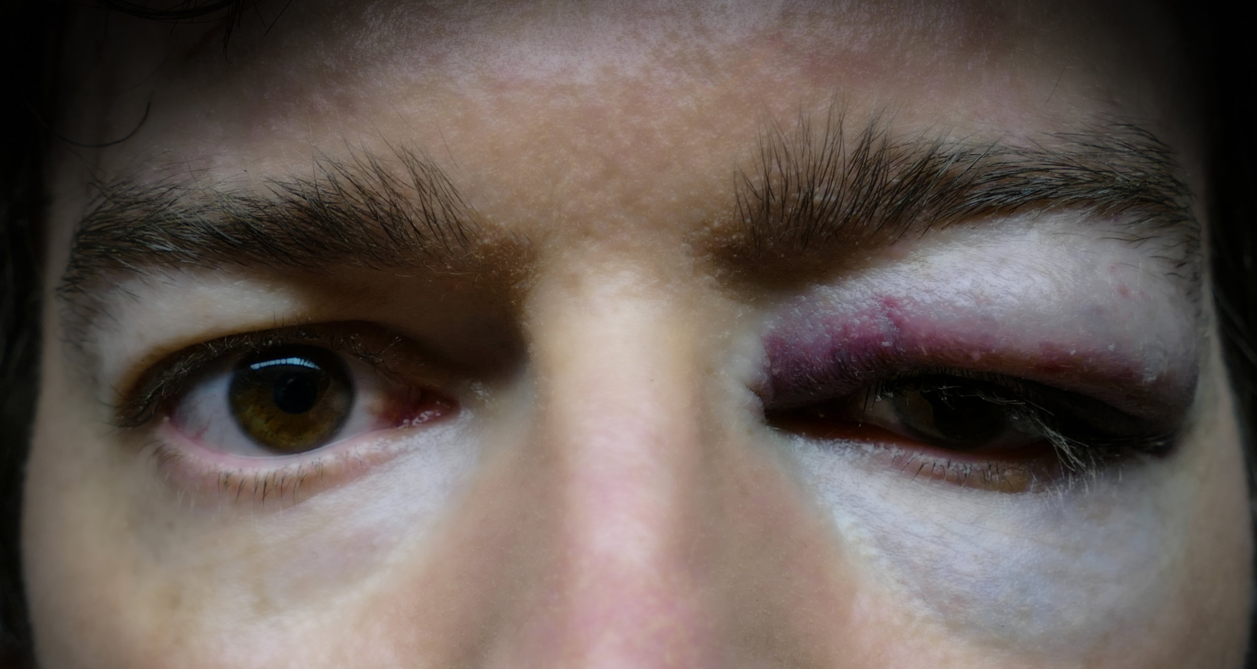 What is Excessive Force?