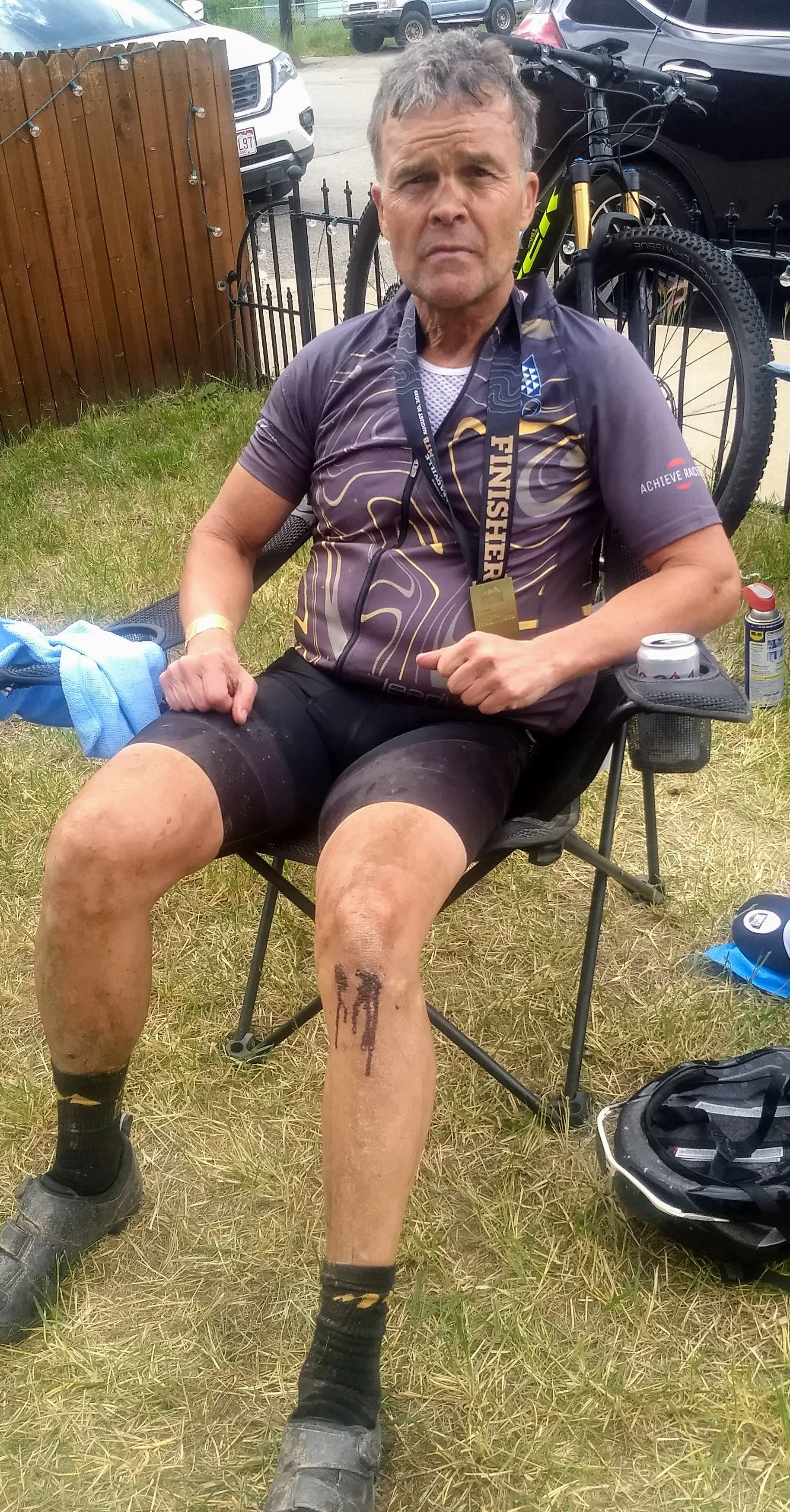 Bloodied Champion Gary Coleman post-race