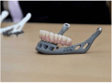 3D-teeth.png