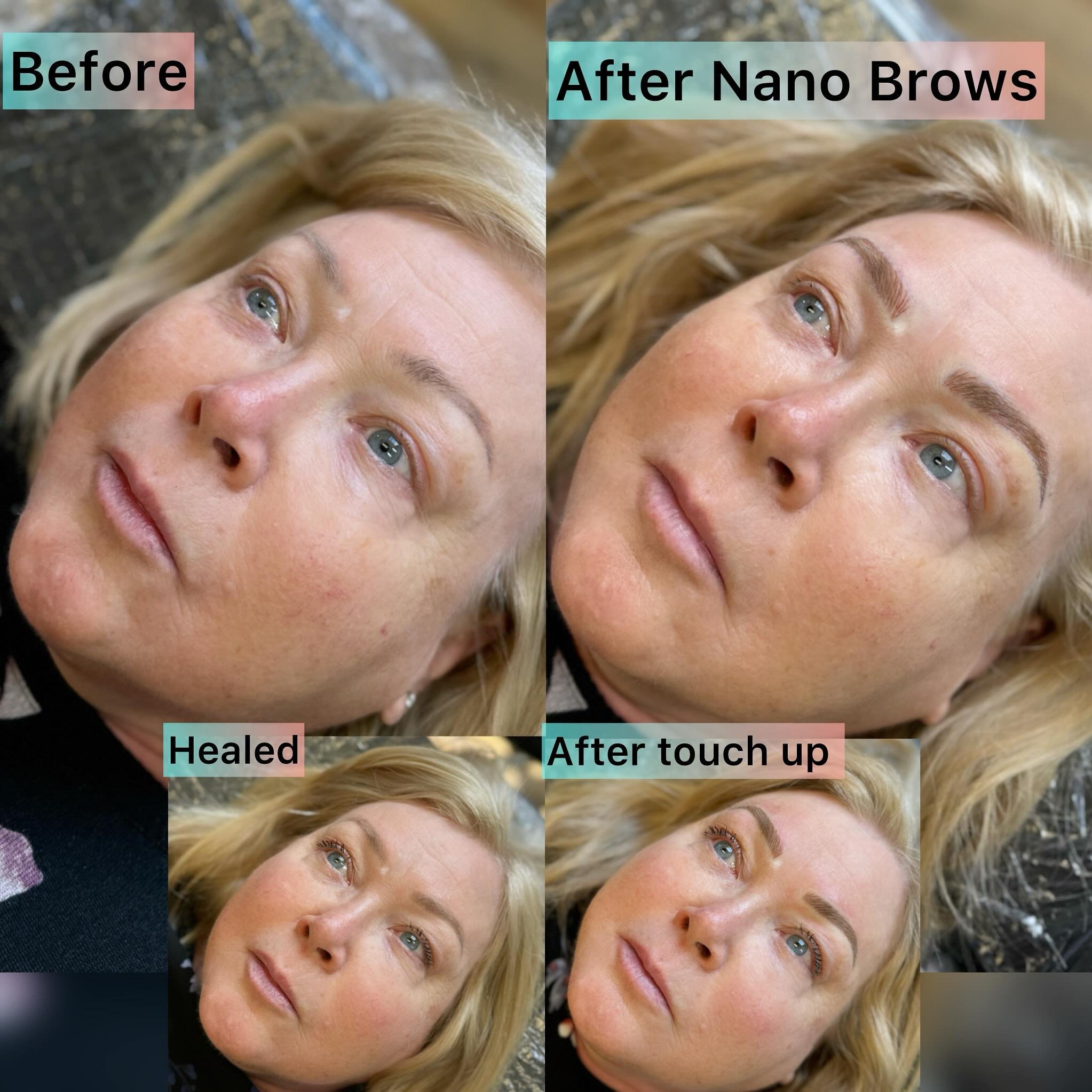 Nano Brow process ✨

Touch ups are important to ensure that each stroke is dark enough. On a first session we need to see how the ink goes into the skin without overworking it and then see how it heals, ESPECIALLY when going over old ink. Everyone&rs