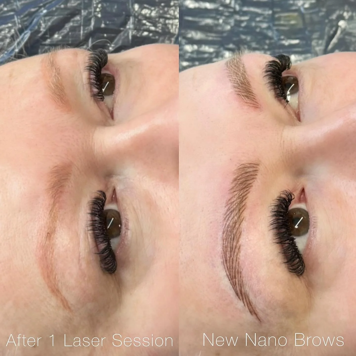 Swipe over to see where we came from ➡️

She&rsquo;s been my client for a long time and we had done her brows multiple times and they still looked good but she wanted less pigment with some really fluffy strokes.

So we did 1 session of laser and got