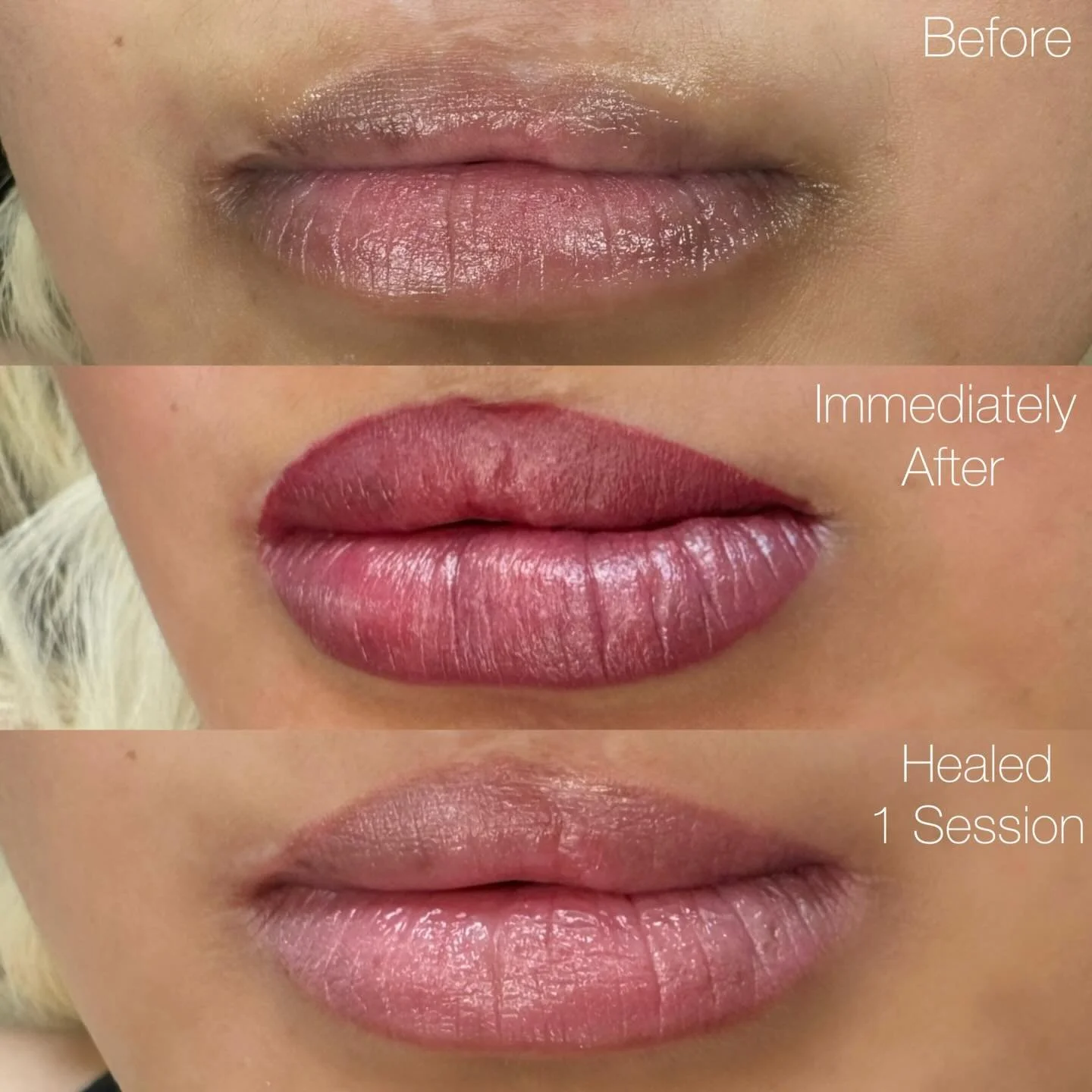 Love the colour that these healed to 💕 

We defined her top lip line a bit more on her touch up but you always want to start more conservatively on scar tissue 🤗

#lips #lipblush #lipblushtattoo #pmulips #pmu #pmuartist #permanentmakeup #cosmeticta