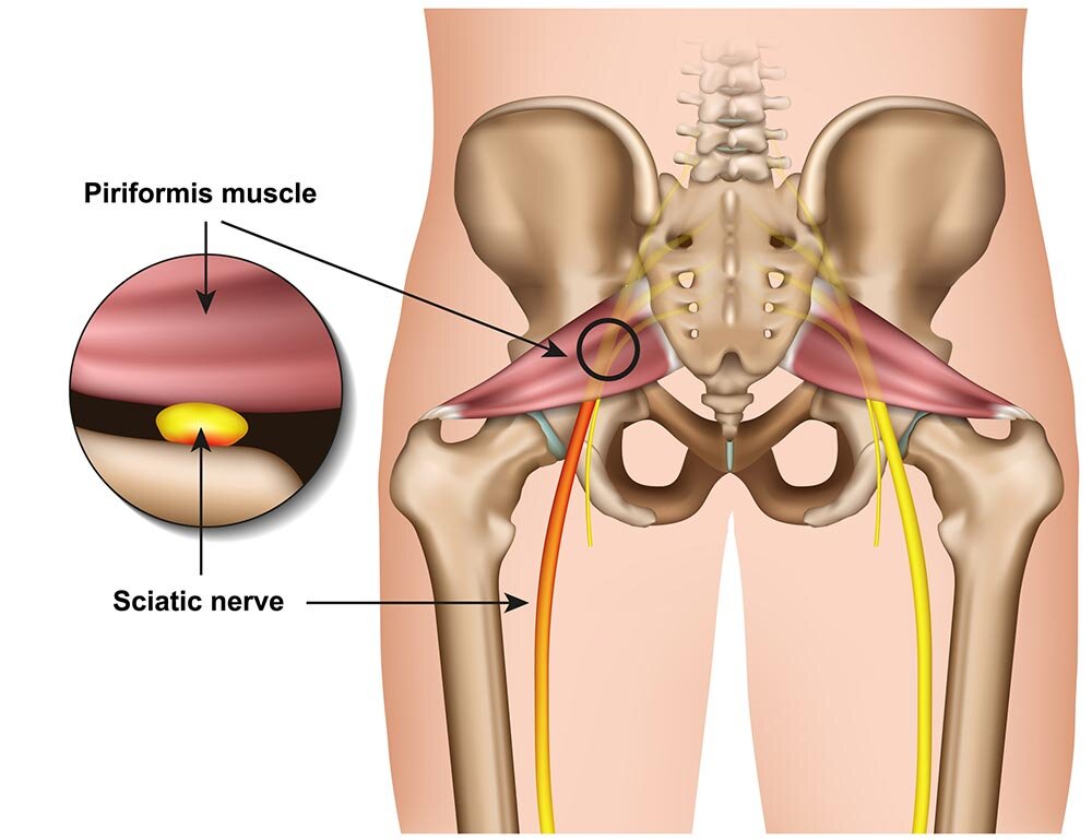 sciatic-nerve.jpg