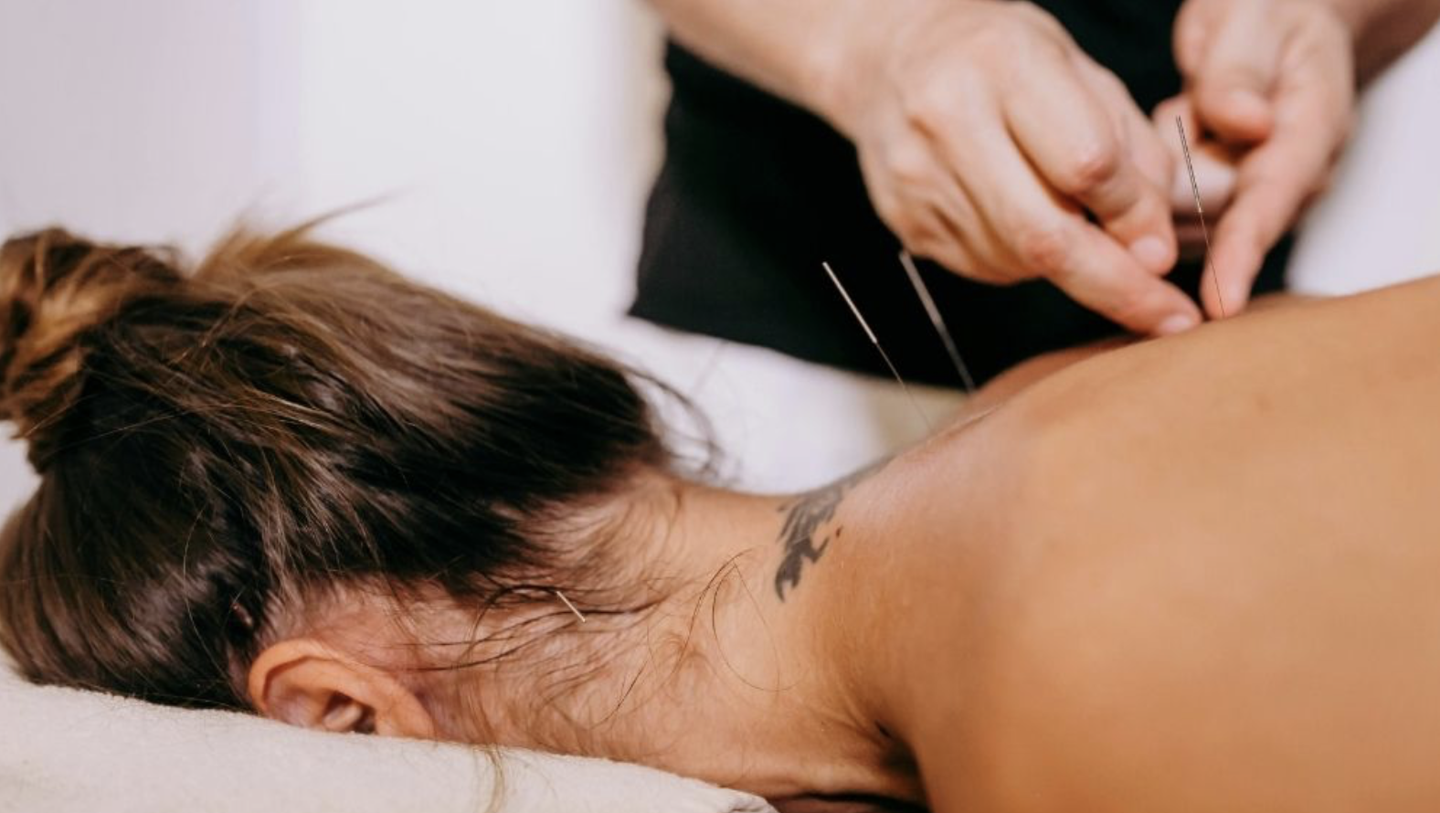 Insider’s Guide to Getting the Most Out of Your Acupuncture Treatments
