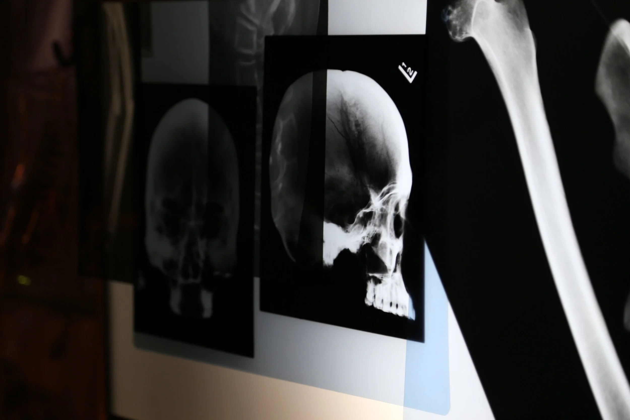 Dark room with a computer screen showing a cosmic or starry background. Several illustrations or posters of skulls are visible, some with a smoky or ethereal appearance.