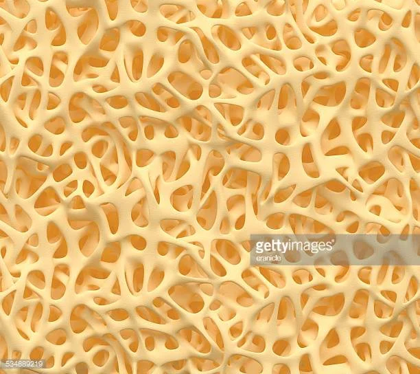 Les mythes entourant l’ostéoporose