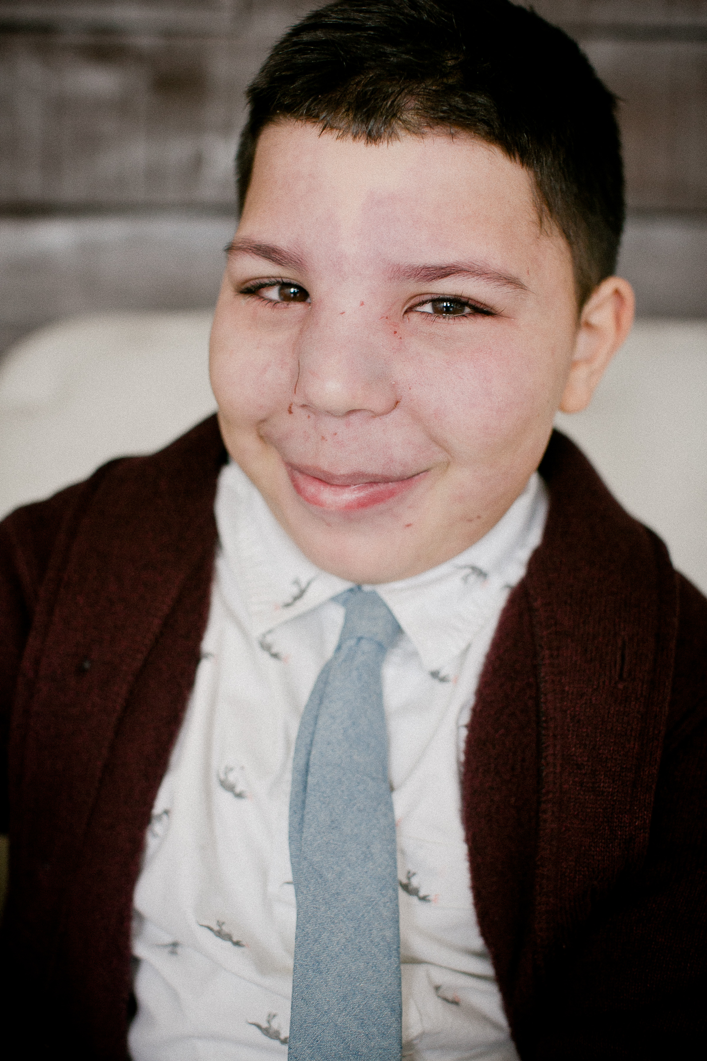 inspiring story on glaucoma .jpg