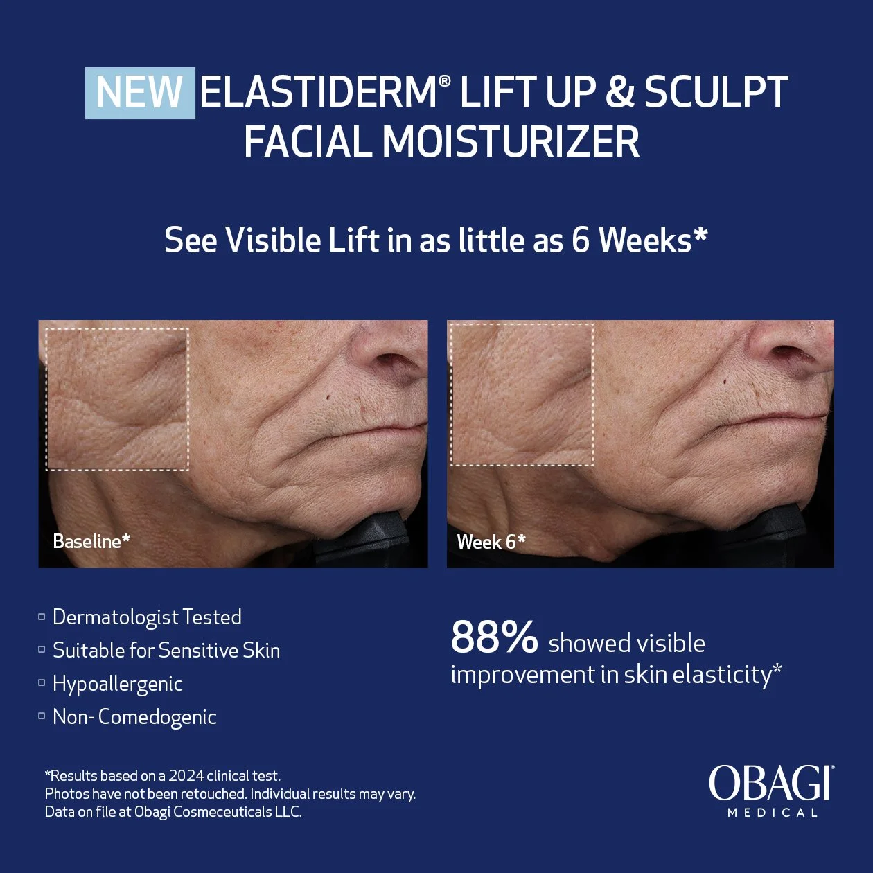 ELASTIderm L&S Moisturizer_V2 BOF_Google + META_1200x1200px copy.jpg