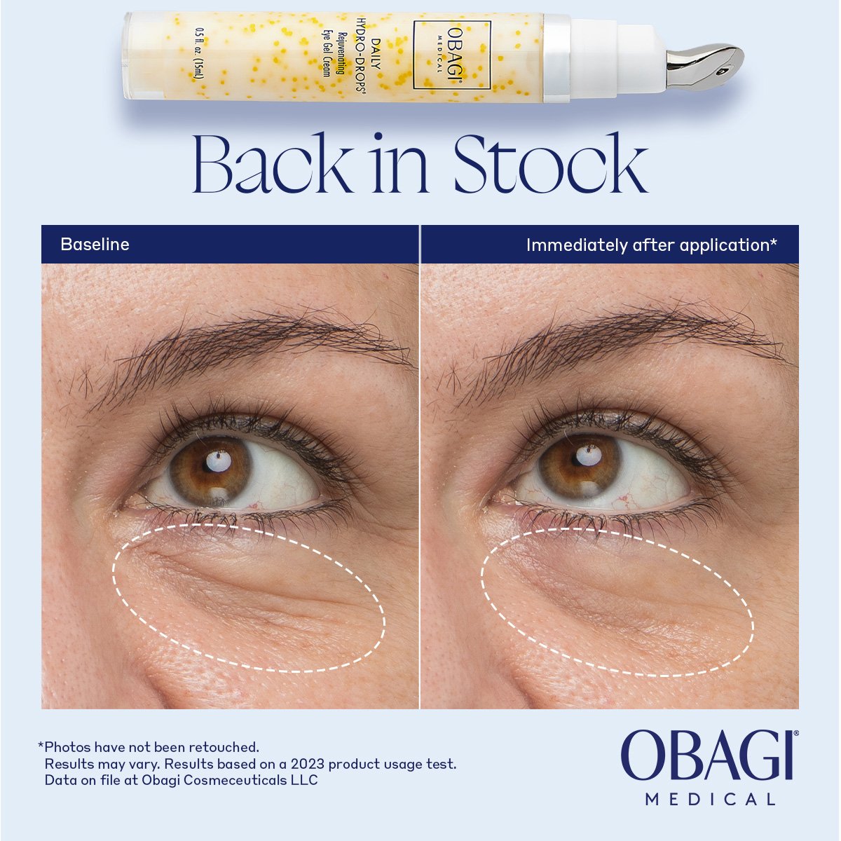 DHD Eye Back in stock_V1_Google + META_1200x1200px.jpg