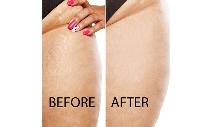 body slimming wrap nyc