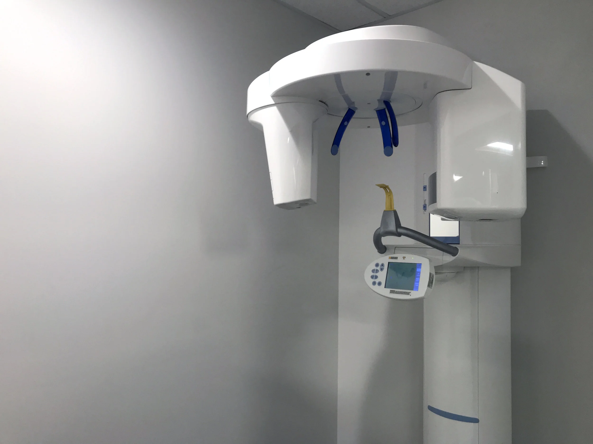 Digital dental X-ray machine used for advanced imaging at Revive Smiles Dentistry in Seattle