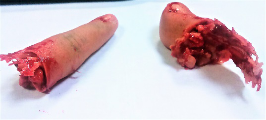 Prosthetics.png