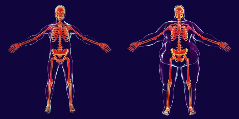 Cancer and Obesity – is there a link?  