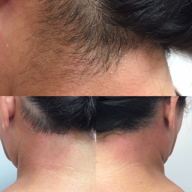 Waxing — The Beauty Routine