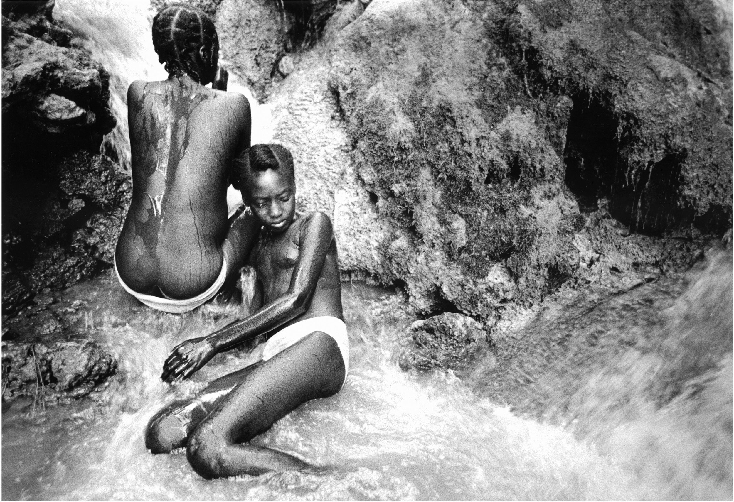 Gingivostomatitis Herpes Dating Haitian Women Desnudo