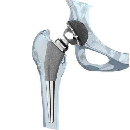 Typical hip replacement components. There are multiple varieties of femoral components and acetabular components now.
