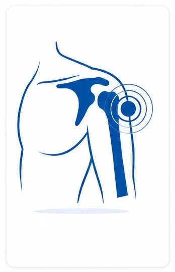 Shoulder Injuries