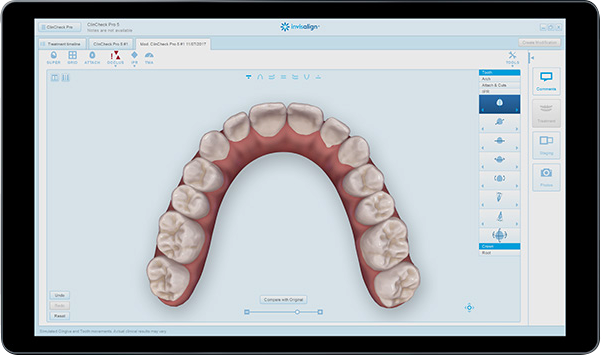 clincheck-c63bdedd3883b5ccb2a8ac79b990b2d42cdcbf0c280bec0ce3c1ed8766d36dc9.png